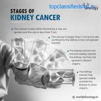 Kidney Operation in Bangalore | Worldofurology