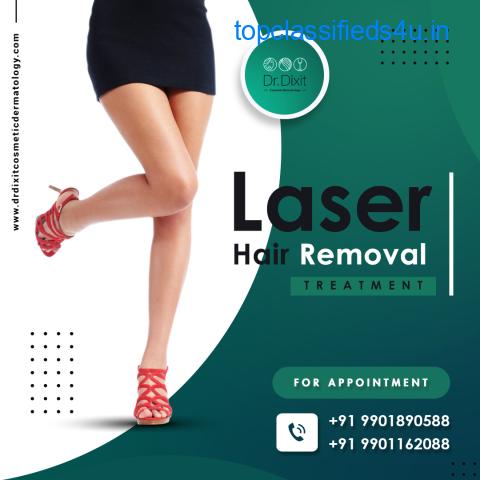 Laser hair removal in Bangalore at Dr. Dixit Dermatology