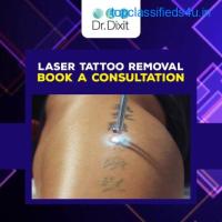 Visit Dr. Rasya Dixit for Tattoo Removal in Bangalore