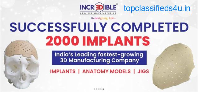 3D Incredible: the best manufacturer of customized 3D printing implants