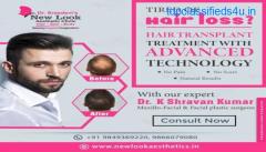 Best Hair Transplant Clinic in Hanamkonda