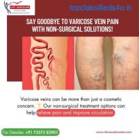 Varicose Veins Treatment Cost In Hyderabad