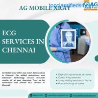 ECG services in Chennai