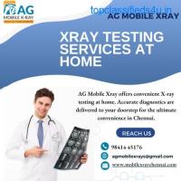 Home X-ray services in mylapore